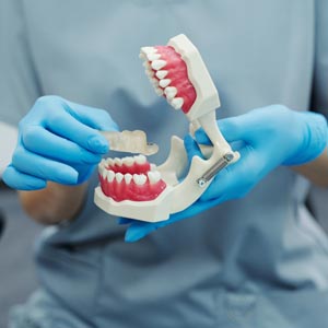 Top 3 Questions About Invisalign Answered By a Cosmetic Dentist!