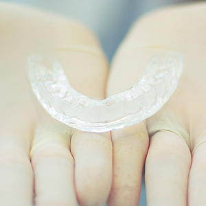 4 Reasons to Try Invisalign This Summer | Los Gatos